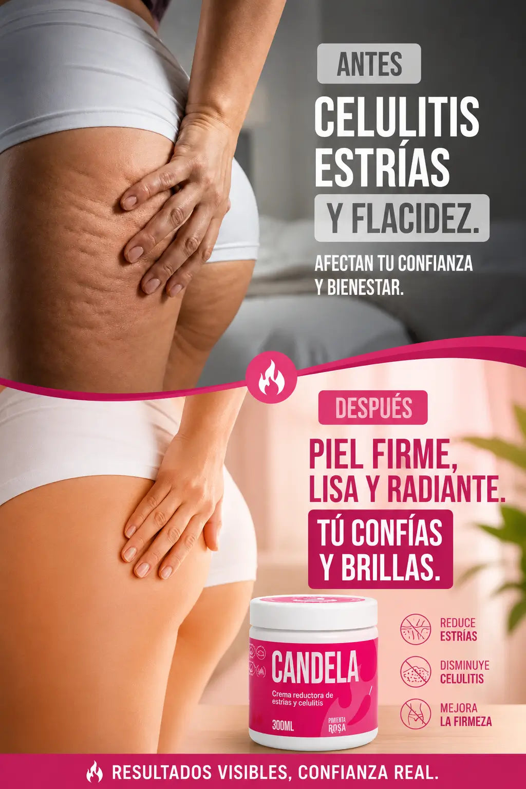 Candela antes y despues